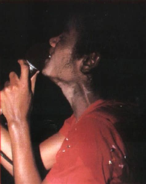 Vitiligo - Michael Jackson Photo (34352216) - Fanpop