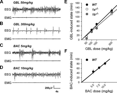 A–D, Representative traces illustrating the effects of GBL and BAC on... | Download Scientific ...