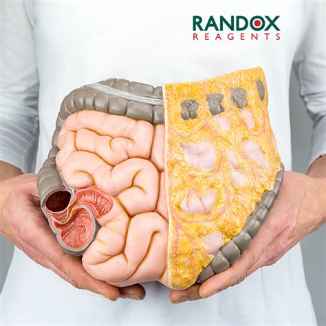 What is Visceral Fat? - Randox Laboratories