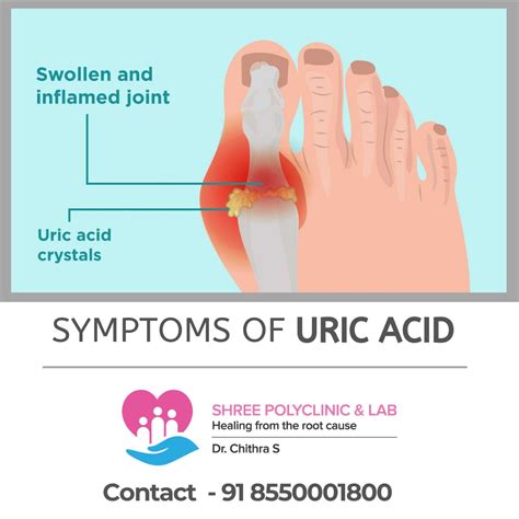 Uric Acid Skin Rash