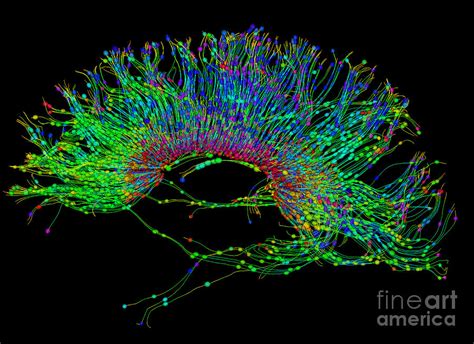 Brain, Fiber Tractography Image Photograph by Scott Camazine - Fine Art ...