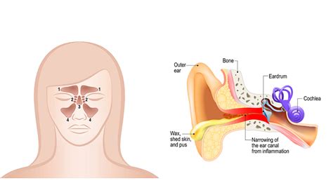 Basics about Ear Infection and Sinus Infection