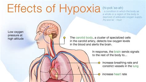 hypoxia | Hypoxia, Nclex rn practice questions, Nclex