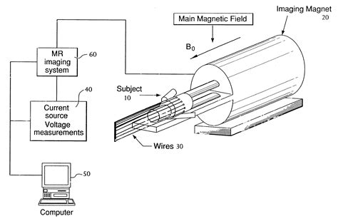 Magnetic resonance-electrical impedance tomography - Eureka | Patsnap ...