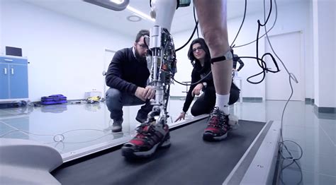 Bionic prosthetic legs: Modern technology expands horizons