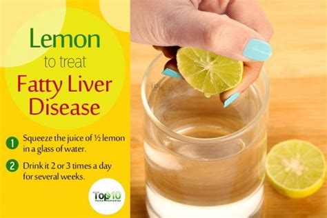 Home Remedies for Fatty Liver Disease | Top 10 Home Remedies