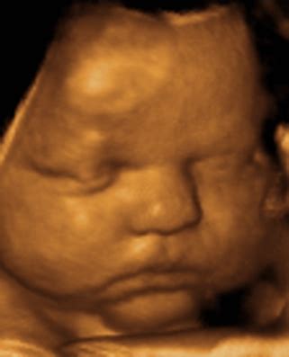 3D and 4D Ultrasound Fetal Images Thrill Expectant Parents