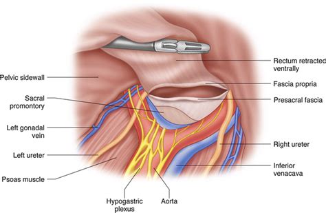 Surgical Anatomy | Abdominal Key