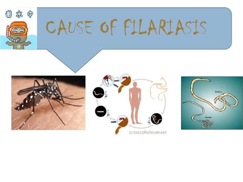 Presentation filariasis