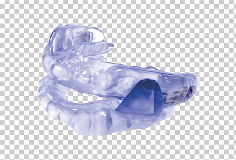 Mandibular Advancement Splint Orthodontics Dentistry Snoring Sleep Apnea PNG, Clipart, Free PNG ...