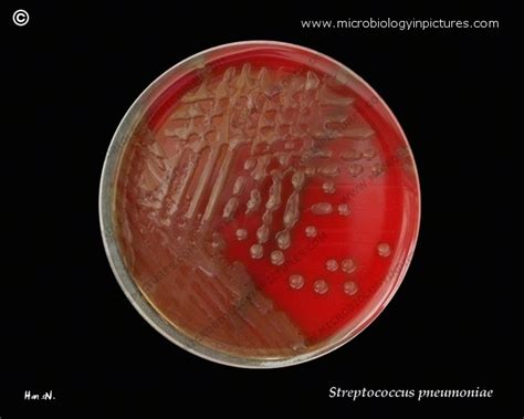 Perenne va a decidir Posdata streptococcus pneumoniae culture media Abundantemente salario para ...