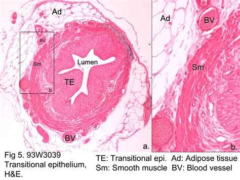 Block1/Fig 5. 93W3039 Transitional epithelium, H&E.