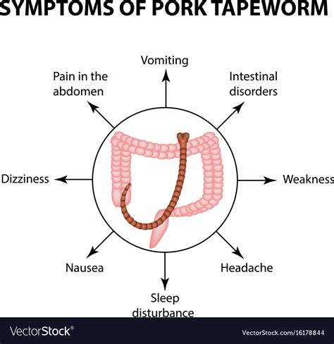 Symptoms of pork tapeworm infographics Royalty Free Vector