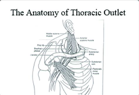 Anatomy of the thoracic outlet | Download Scientific Diagram