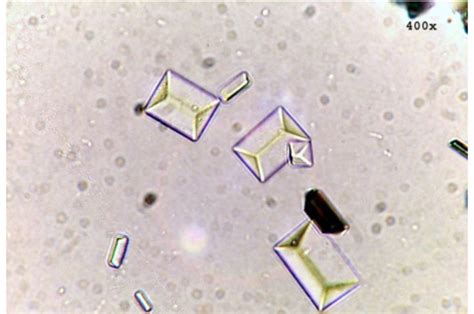 Urinalysis - Microscopic (Renal) Flashcards | Memorang | Medical ...