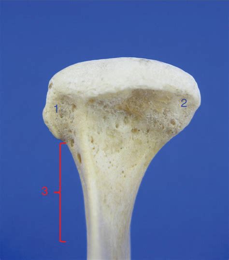 8: Temporomandibular Joint | Pocket Dentistry