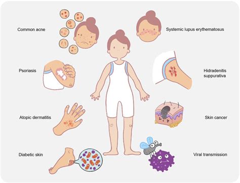 Skin bacterial microbiota in human disease. Skin microbial disorders in... | Download Scientific ...