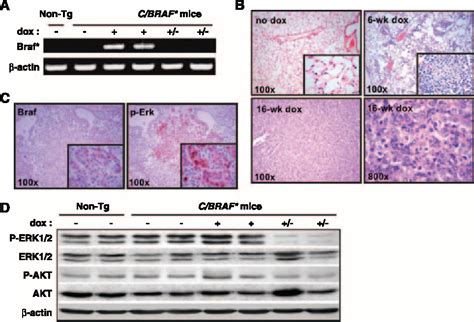 Figure 1 from Mutations in BRAF and KRAS converge on activation of the mitogen-activated protein ...