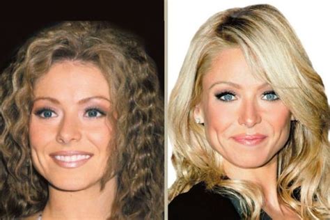 Kelly Ripa before and after plastic surgery (9) – Celebrity plastic ...