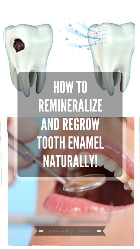 How To Remineralize And Regrow Tooth Enamel Naturally! | Tooth enamel, Fix teeth, Strengthen teeth