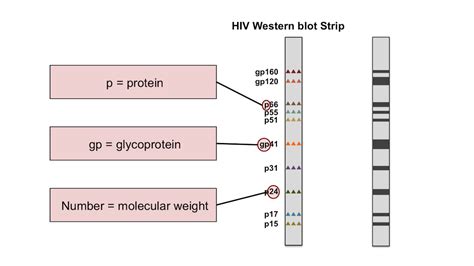 Describe Why the Hiv Western Blot Is a More - Case-has-Dudley