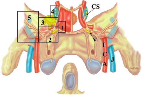 6. Drawing of the coronal plane of the cranial base demonstrating the... | Download Scientific ...