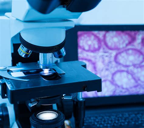 Anatomic Pathology – Analyze Pathology