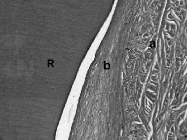 The SCTG group. a, Subepithelial connective tissue graft characterized ...