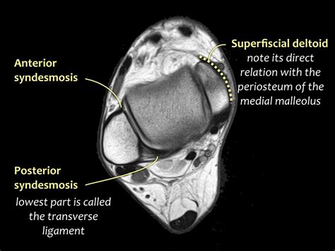 The Radiology Assistant : Ankle - MRI examination