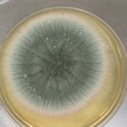 Aspergillus Flavus - Symptoms, Disease, & Treatment | Mold Busters