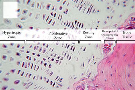 Epiphyseal Plate