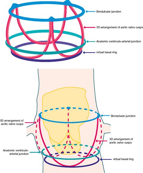 Aortic Valve Annulus