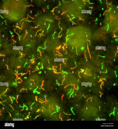 Lyme Disease Bacteria, Borrelia burgdorferi Lyme disease spirochete, Borrelia burgdorferi, is an ...