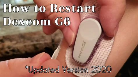 How to Restart Dexcom G6 Sensor | 2020 - YouTube