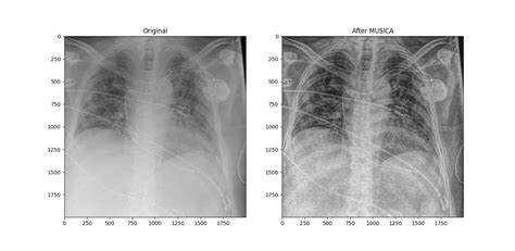 GitHub - bitcg/Contrast-enhancement-Laplacian-pyramid: A contrast ...