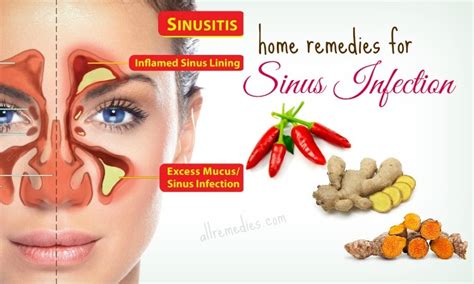 20 Best Natural Home Remedies for Sinus Infection in Adults