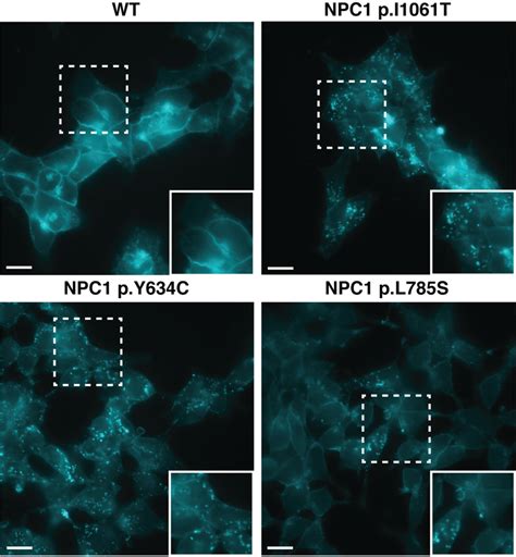 Filipin staining of haploid models of NPC1 variants. Wild-type (WT)... | Download Scientific Diagram