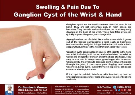 Pin on Hand Treatment