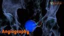 Angiography