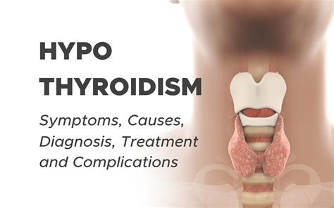 Hypothyroidism (Underactive Thyroid): Symptoms, Causes, Diagnosis, Treatment and Complications ...