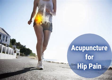 Success with Acupuncture for Hip Pain | Acupuncture Continuing Education