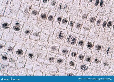 Interphase Mitosis Under Microscope