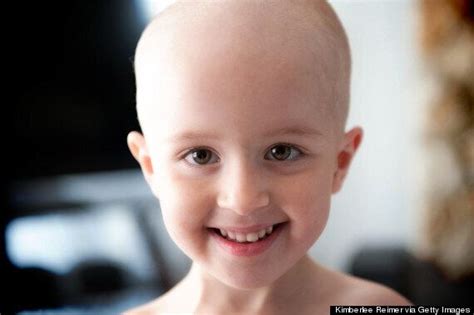 Survival Rates For Cancer In Children Have Increased, Cancer Research ...