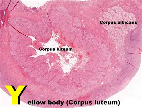 Corpus Albicans Histology