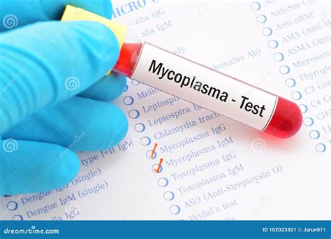 mycoplasma lab test – mycoplasma pneumoniae test – Brilnt