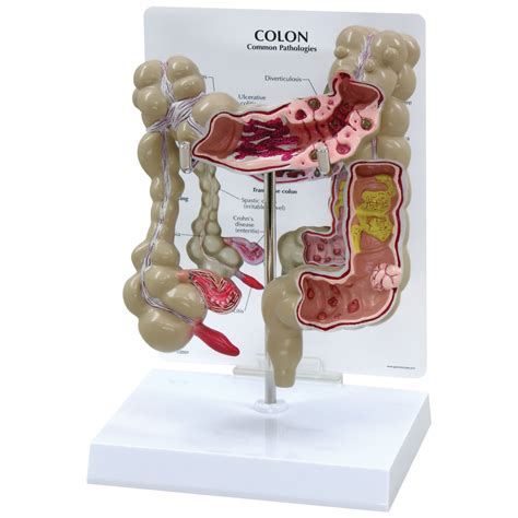 Colon Model - Digestive System - Human Anatomy - Biology