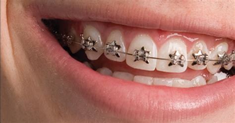 Affordable Las Vegas Dentist & Orthodontist - Nevada Dentistry