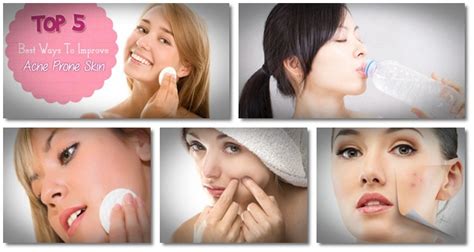 Diet for Acne Prone Skin | “Acne Remedies Guide” Reveals to People a ...