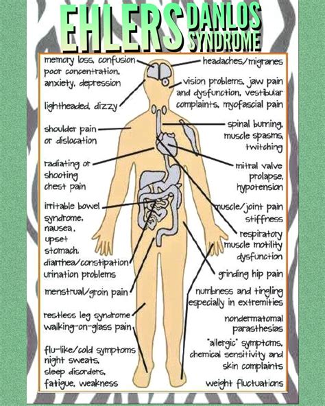 EDS symptom chart #headachechart | Ehlers danlos syndrome symptoms, Ehlers danlos syndrome ...