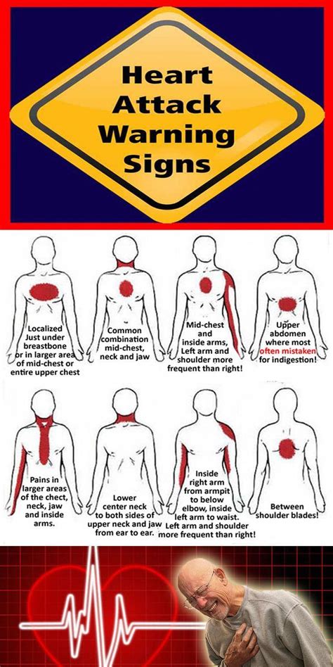 What Are Indicators Of A Heart Attack - PELAJARAN